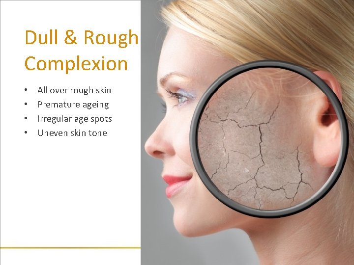 Dull & Rough Complexion • • All over rough skin Premature ageing Irregular age