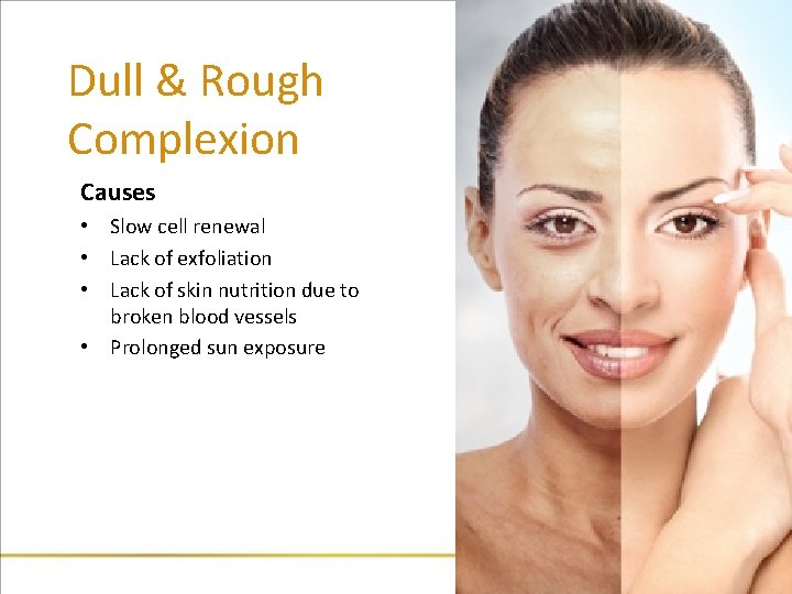 Dull & Rough Complexion Causes • Slow cell renewal • Lack of exfoliation •