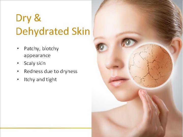 Dry & Dehydrated Skin • Patchy, blotchy appearance • Scaly skin • Redness due