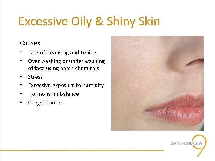 Excessive Oily & Shiny Skin Causes • Lack of cleansing and toning • Over