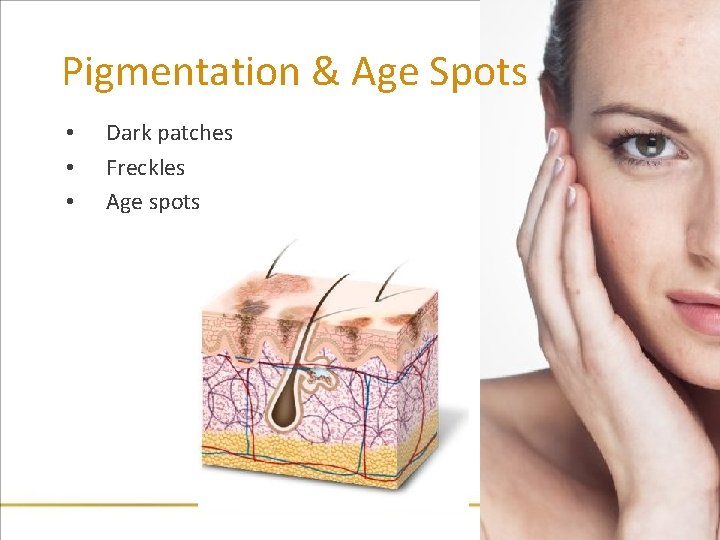 Pigmentation & Age Spots • • • Dark patches Freckles Age spots 