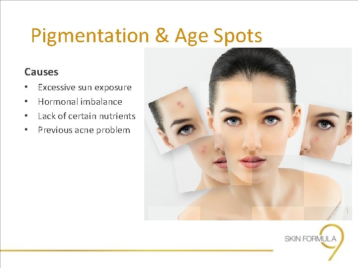 Pigmentation & Age Spots Causes • • Excessive sun exposure Hormonal imbalance Lack of