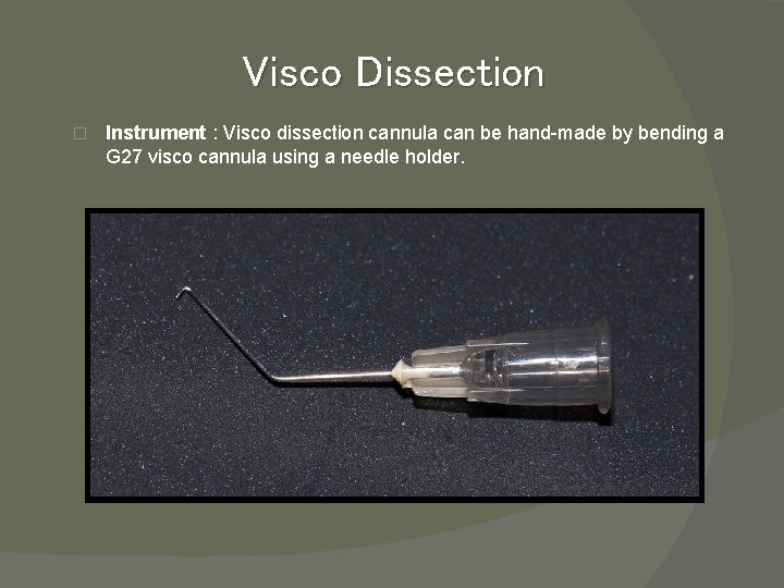 Visco Dissection � Instrument : Visco dissection cannula can be hand-made by bending a