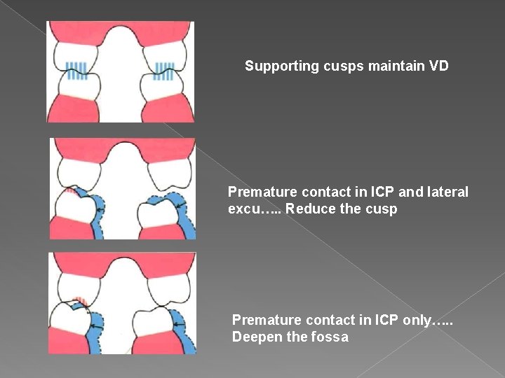 Supporting cusps maintain VD Premature contact in ICP and lateral excu…. . Reduce the