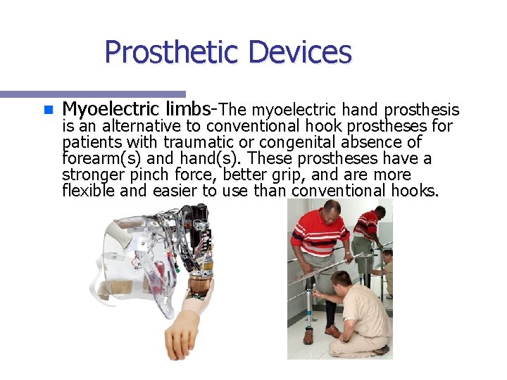 Prosthetic Devices n Myoelectric limbs-The myoelectric hand prosthesis is an alternative to conventional hook