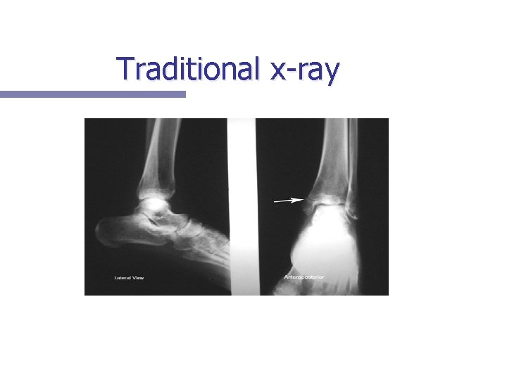 Traditional x-ray 