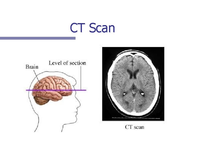 CT Scan 