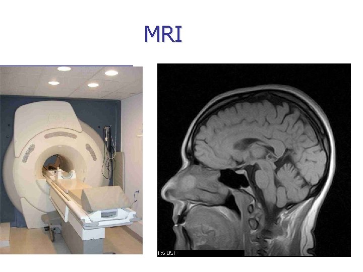 MRI 