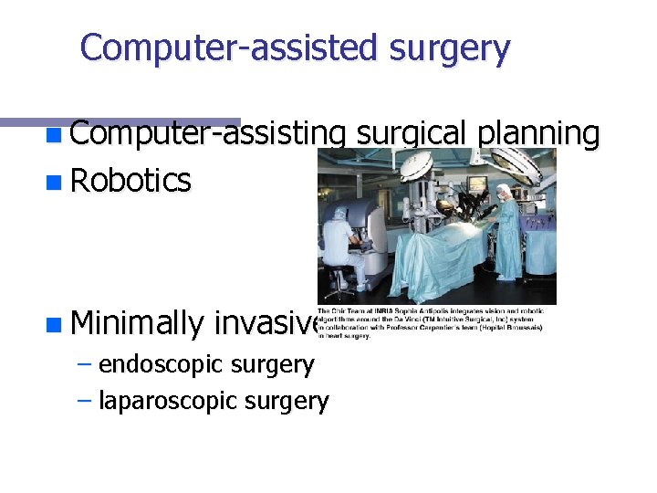 Computer-assisted surgery n Computer-assisting surgical planning n Robotics n Minimally invasive surgery – endoscopic