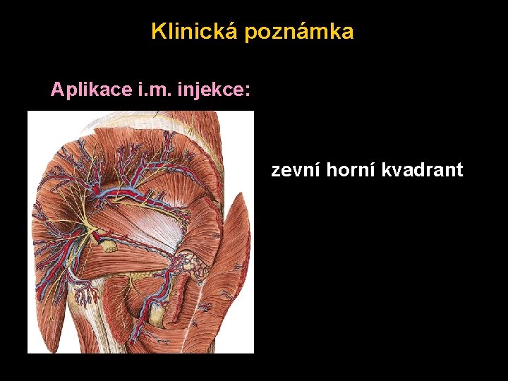 Klinická poznámka Aplikace i. m. injekce: zevní horní kvadrant 