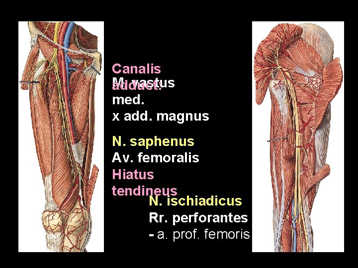 Canalis M. vastus adduct: med. x add. magnus N. saphenus Av. femoralis Hiatus tendineus