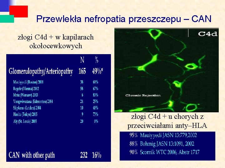 Przewlekła nefropatia przeszczepu – CAN złogi C 4 d + w kapilarach okołocewkowych złogi