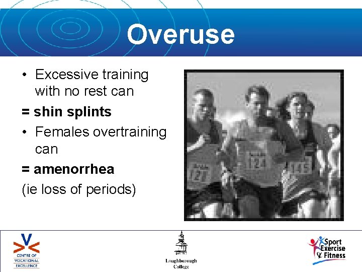 Overuse • Excessive training with no rest can = shin splints • Females overtraining