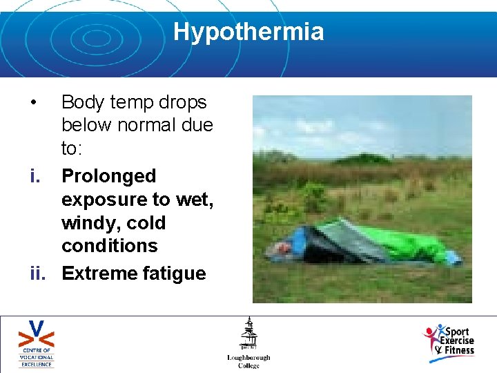 Hypothermia • Body temp drops below normal due to: i. Prolonged exposure to wet,