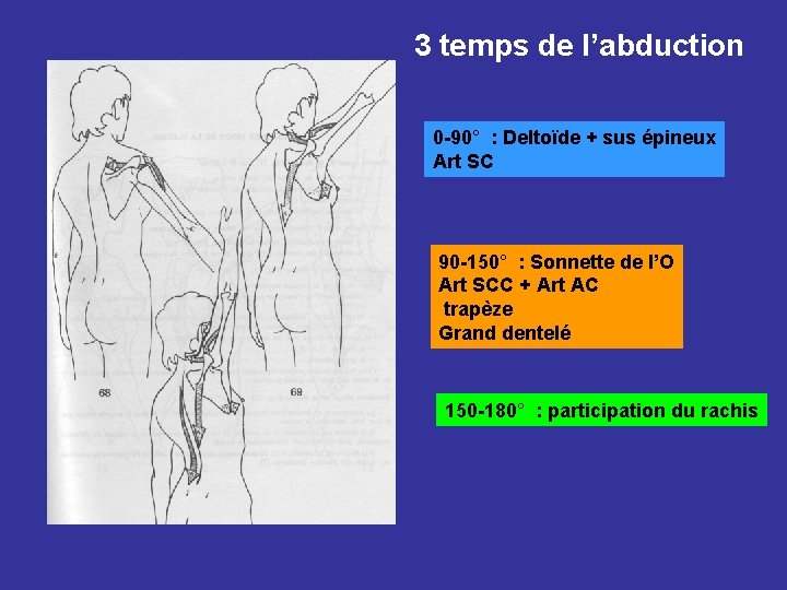 3 temps de l’abduction 0 -90° : Deltoïde + sus épineux Art SC 90