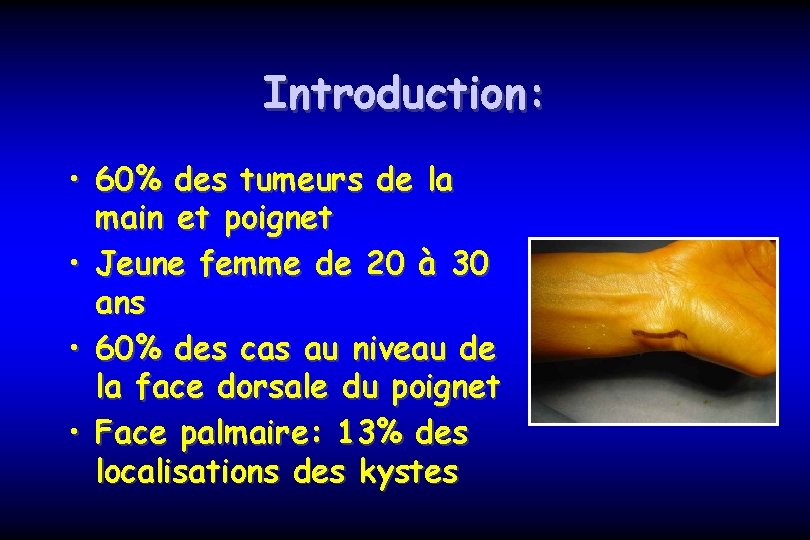 Introduction: • 60% des tumeurs de la main et poignet • Jeune femme de