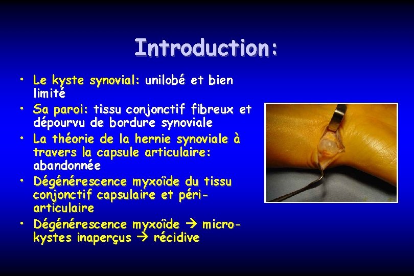 Introduction: • Le kyste synovial: unilobé et bien limité • Sa paroi: tissu conjonctif