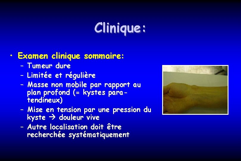 Clinique: • Examen clinique sommaire: – – – Tumeur dure Limitée et régulière Masse