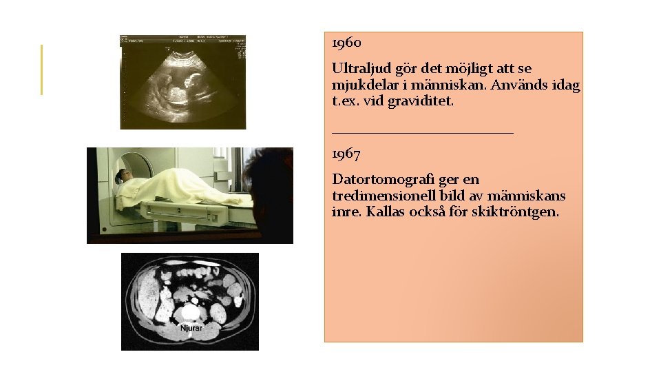  1960 Ultraljud gör det möjligt att se mjukdelar i människan. Används idag t.