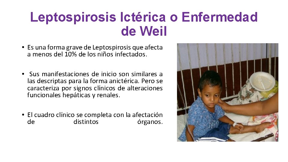 Leptospirosis Ictérica o Enfermedad de Weil • Es una forma grave de Leptospirosis que