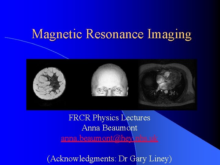 Magnetic Resonance Imaging FRCR Physics Lectures Anna Beaumont anna. beaumont@hey. nhs. uk (Acknowledgments: Dr