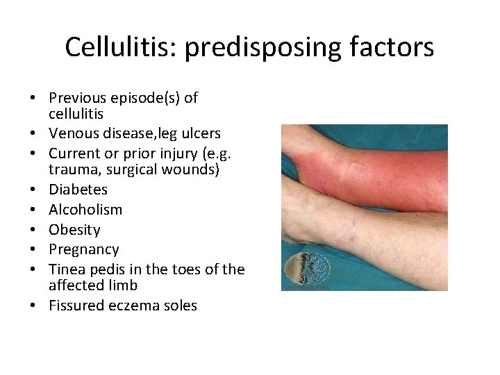 Cellulitis: predisposing factors • Previous episode(s) of cellulitis • Venous disease, leg ulcers • Cellulitis: predisposing factors • Previous episode(s) of cellulitis • Venous disease, leg ulcers •