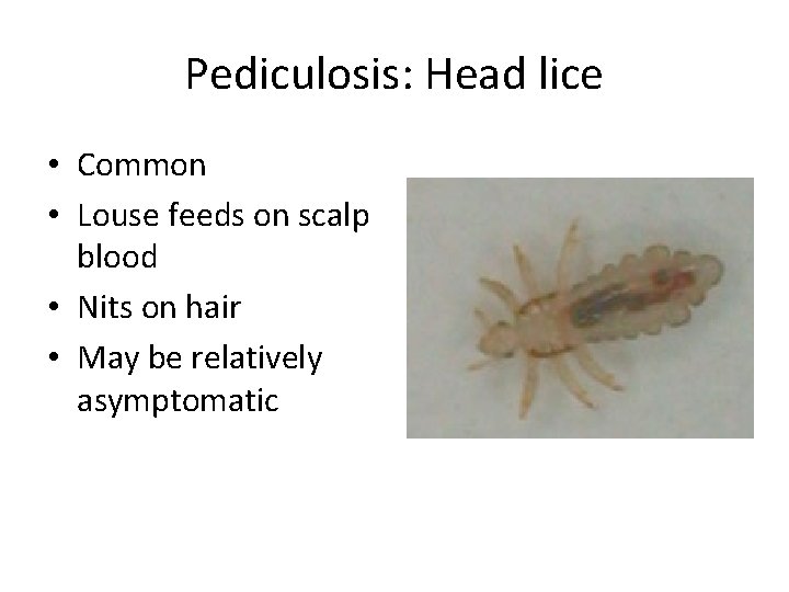 Pediculosis: Head lice • Common • Louse feeds on scalp blood • Nits on Pediculosis: Head lice • Common • Louse feeds on scalp blood • Nits on