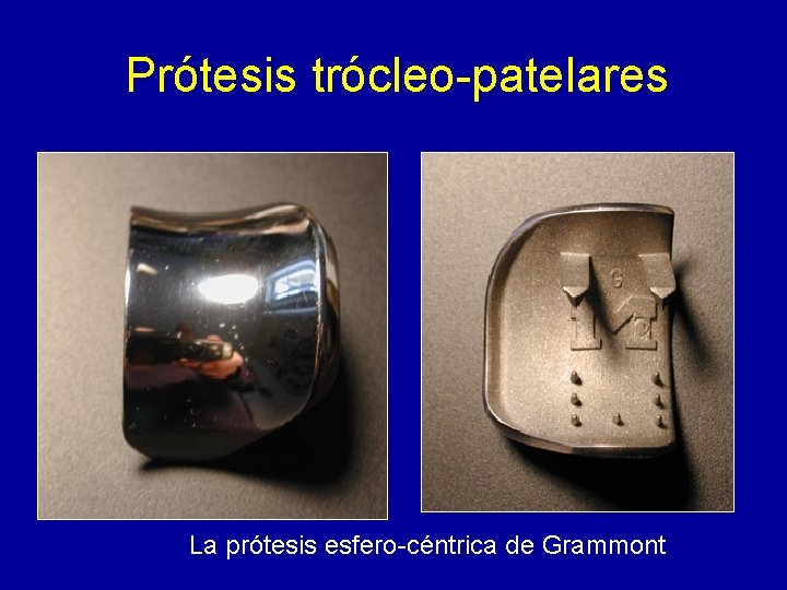 Prótesis trócleo-patelares La prótesis esfero-céntrica de Grammont 