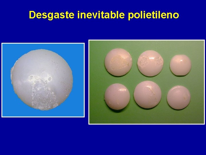 Desgaste inevitable polietileno 