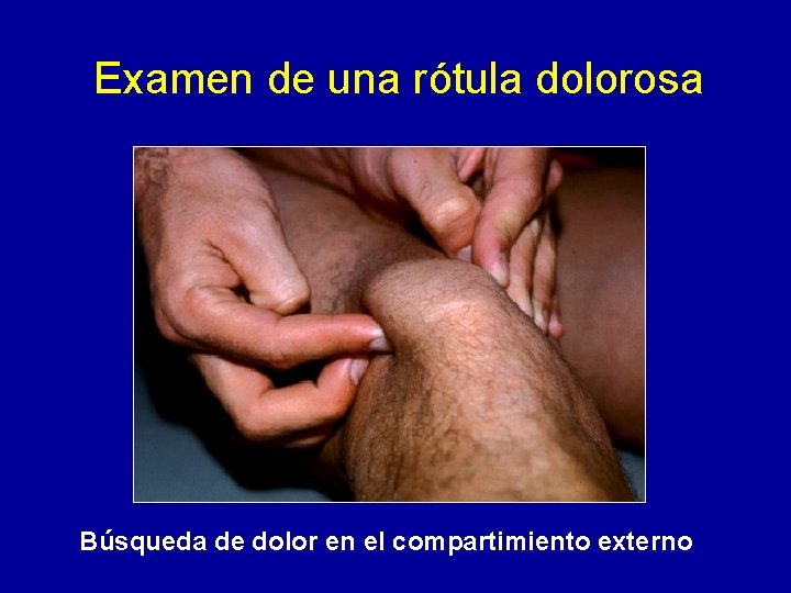 Examen de una rótula dolorosa Búsqueda de dolor en el compartimiento externo 