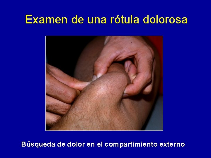 Examen de una rótula dolorosa Búsqueda de dolor en el compartimiento externo 