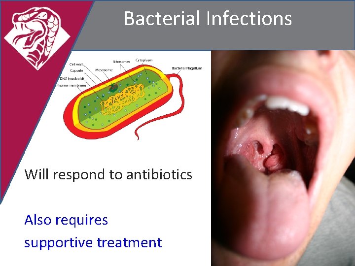 Bacterial Infections Will respond to antibiotics Also requires supportive treatment 