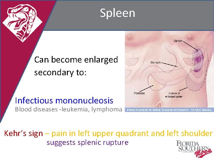 Spleen Can become enlarged secondary to: Infectious mononucleosis Blood diseases -leukemia, lymphoma Kehr’s sign
