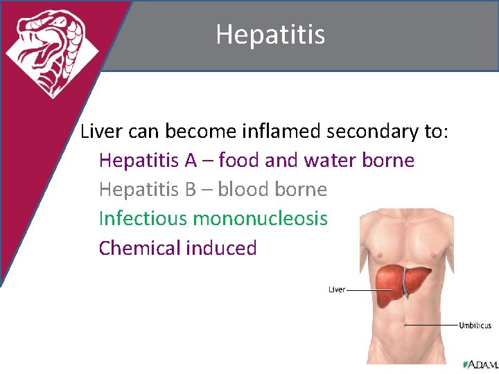 Hepatitis Liver can become inflamed secondary to: Hepatitis A – food and water borne