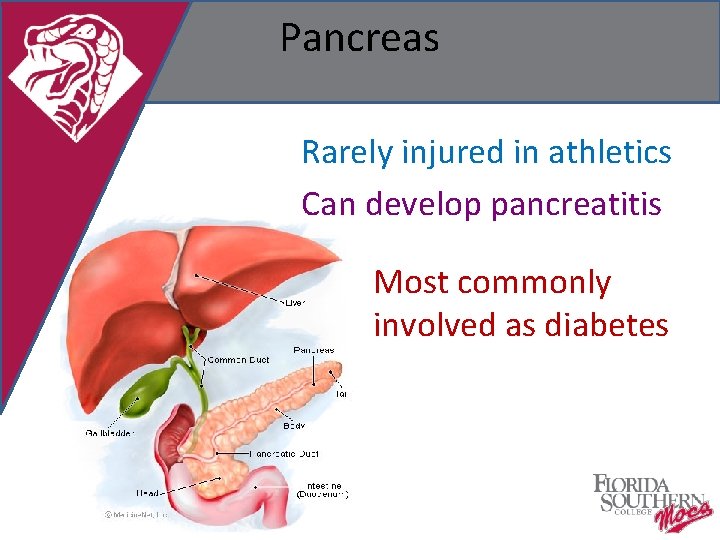 Pancreas Rarely injured in athletics Can develop pancreatitis Most commonly involved as diabetes 