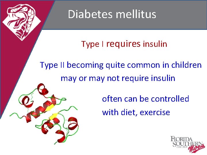 Diabetes mellitus Type I requires insulin Type II becoming quite common in children may
