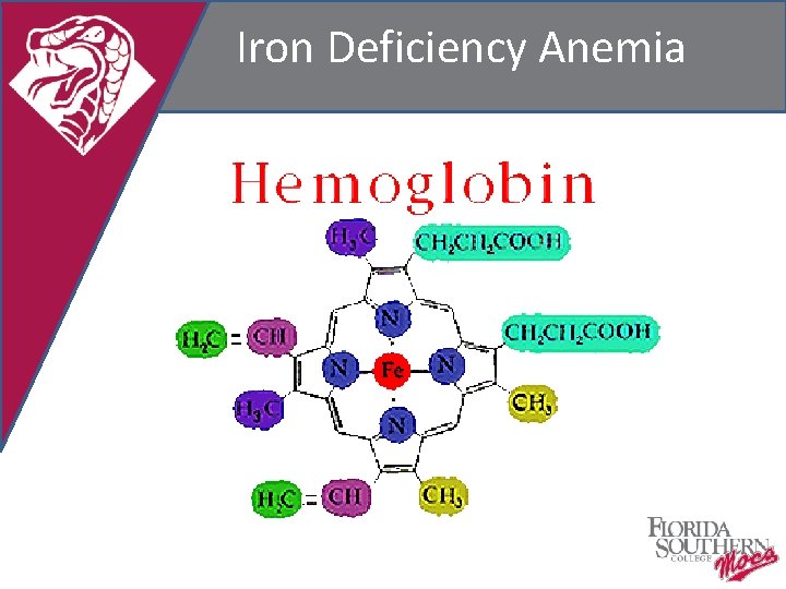 Iron Deficiency Anemia 