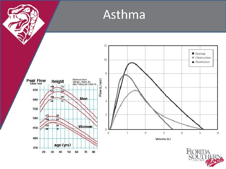 Asthma 