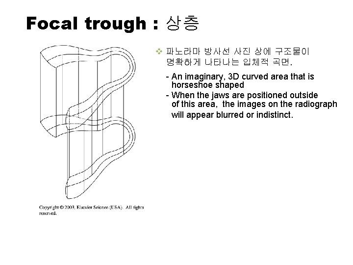 Focal trough : 상층 v 파노라마 방사선 사진 상에 구조물이 명확하게 나타나는 입체적 곡면.