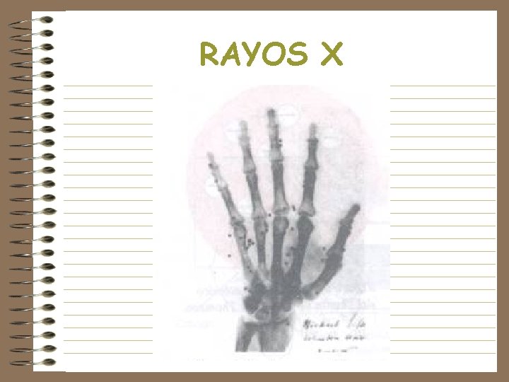 RAYOS X 