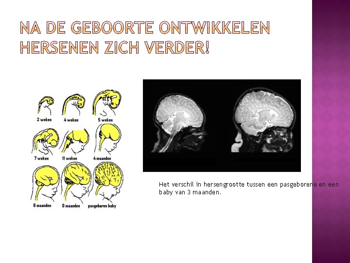 Het verschil in hersengrootte tussen een pasgeborene en een baby van 3 maanden. 