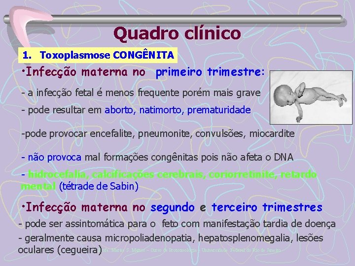 Quadro clínico 1. Toxoplasmose CONGÊNITA • Infecção materna no primeiro trimestre: - a infecção