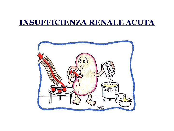 INSUFFICIENZA RENALE ACUTA 