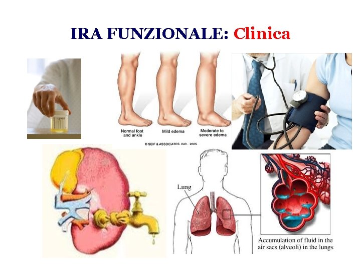 IRA FUNZIONALE: Clinica 