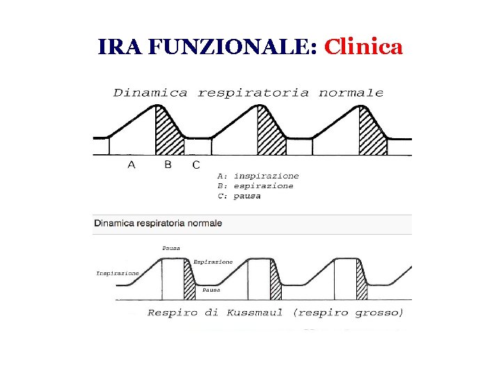 IRA FUNZIONALE: Clinica 