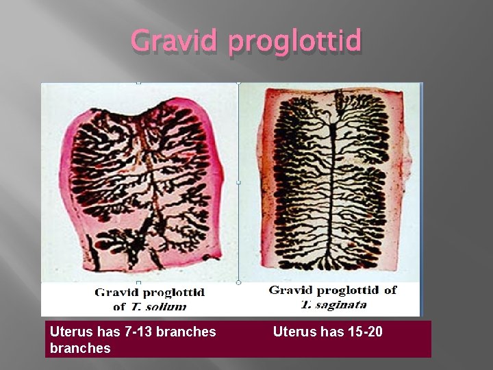 Gravid proglottid Uterus has 7 -13 branches Uterus has 15 -20 