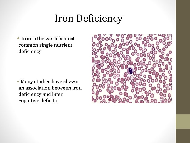 Iron Deficiency • Iron is the world’s most common single nutrient deficiency. • Many