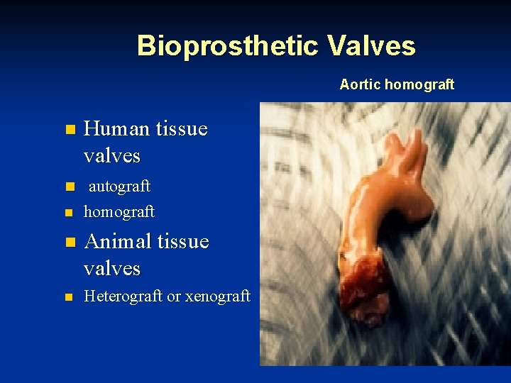 Bioprosthetic Valves Aortic homograft n Human tissue valves n autograft n homograft n Animal