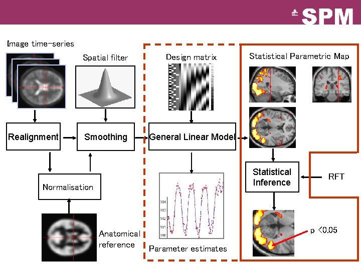 Image time-series Realignment Spatial filter Design matrix Smoothing General Linear Model Statistical Parametric Map Image time-series Realignment Spatial filter Design matrix Smoothing General Linear Model Statistical Parametric Map