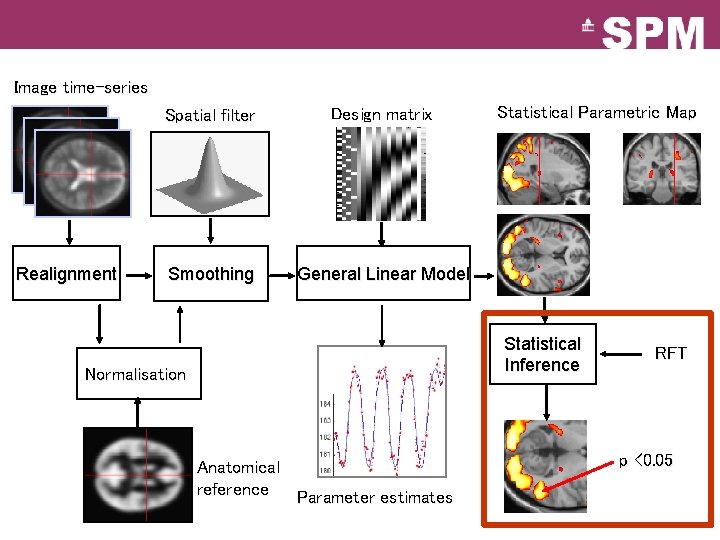 Image time-series Realignment Spatial filter Design matrix Smoothing General Linear Model Statistical Parametric Map Image time-series Realignment Spatial filter Design matrix Smoothing General Linear Model Statistical Parametric Map